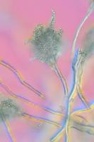 Penicillium  - Conidiophores et conidies x100